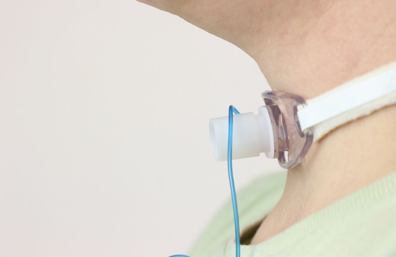 Close up view of a tracheostomy in a adult woman neck